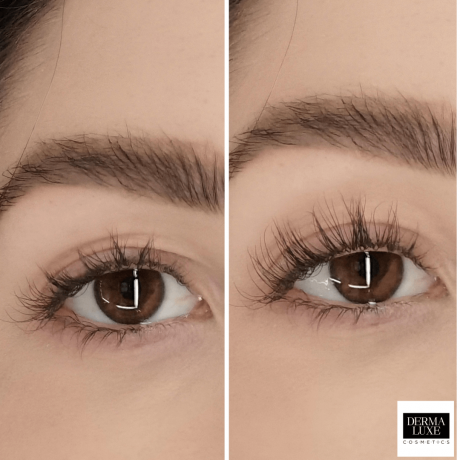 before-after