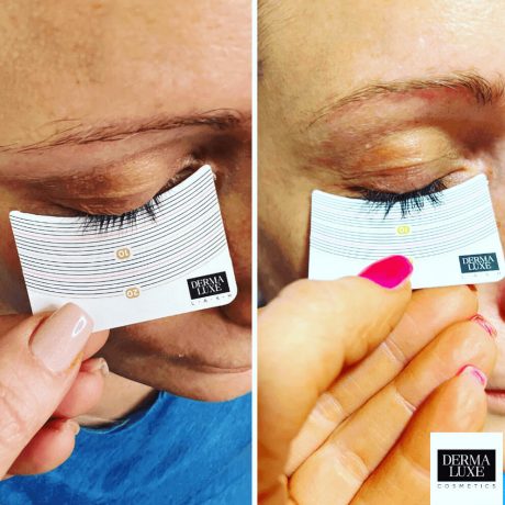 before-after-katja