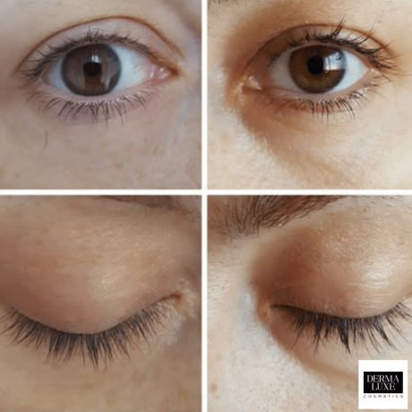 stranka-before-after