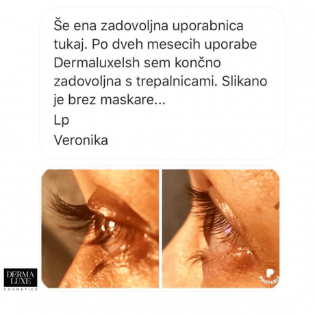 before-after-veronika