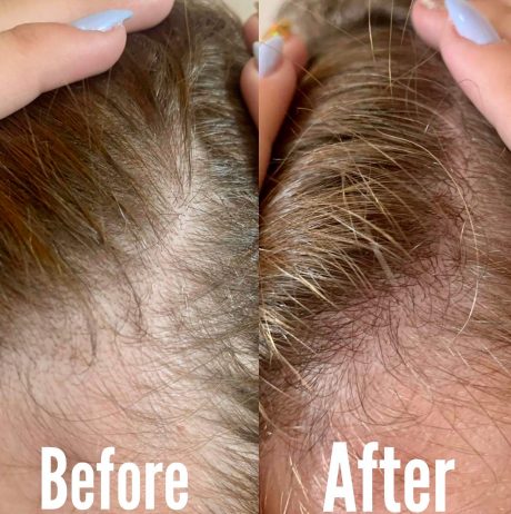 Derma-Luxehair hair growth serum